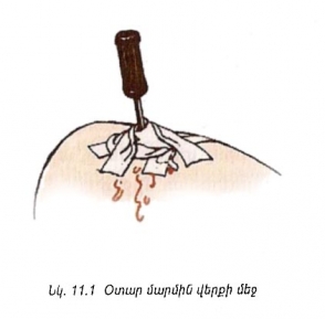 Ձերբակալվել է