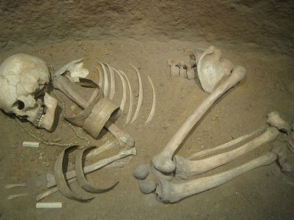 Միջնադարյան Իտալիայի բնակիչը բրուցելոզի զոհ է դարձել