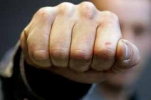 Բռունցքի հարվածներ վիճաբանության ժամանակ