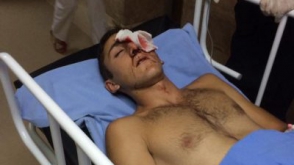 17-ամյա դեռահասը բախումներում կորցրել է աչքը (տեսանյութ)