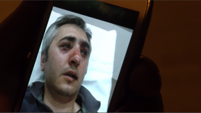 Տուժած ցուցարար. «Կարծես հաճույք էին ստանում հարվածելուց, զուգահեռ հայհոյում էին»