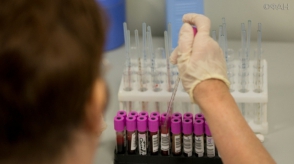 Գիտնականները հայտնաբերել են արյան 2 նոր խումբ