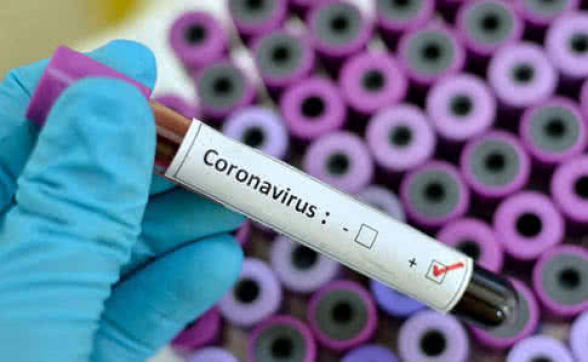 Коронавирус выявил очевидное: приключения мойшаговцев в тылу вируса