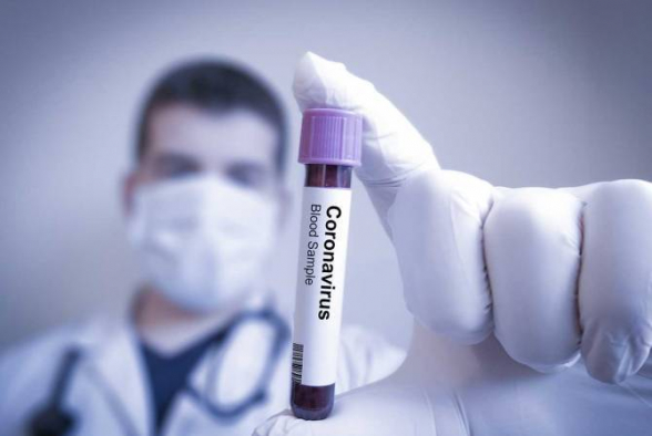 Կապանում կա կորոնավիրուսային հիվանդության հաստատված 9 դեպք, իսկ Մեղրիում՝ 8