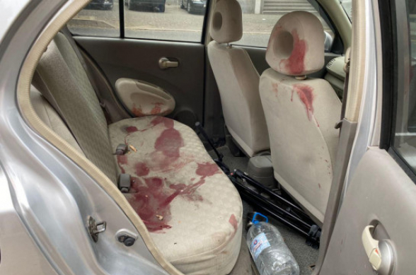 Արցախ. վիրավոր լրագրողներին տեղափոխող մեքենան (լուսանկար)