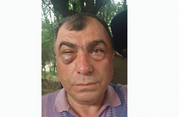«Հայաստան» դաշինքի ներկայացուցչին ծեծել է բանգլադեշցի Կարենը՝ Եղեգնաձորի ոստիկանների հետ միասին