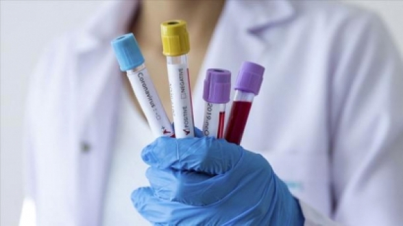  Стоимость тестов на коронавирус вновь может достичь 20 тысяч драмов – «Жоховурд»
