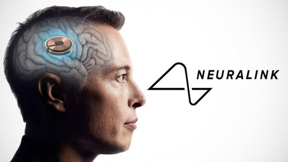 Клинические испытания импланта «Neuralink» впервые проведут за пределами США